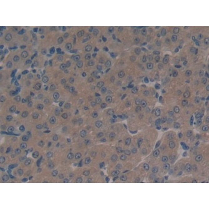Multidrug Resistance Associated Protein 1 (MRP1) Mouse Polyclonal Antibody
