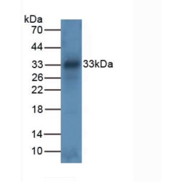 Tryptase (TPS) Human Polyclonal Antibody