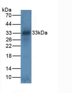 Tryptase (TPS) Human Polyclonal Antibody