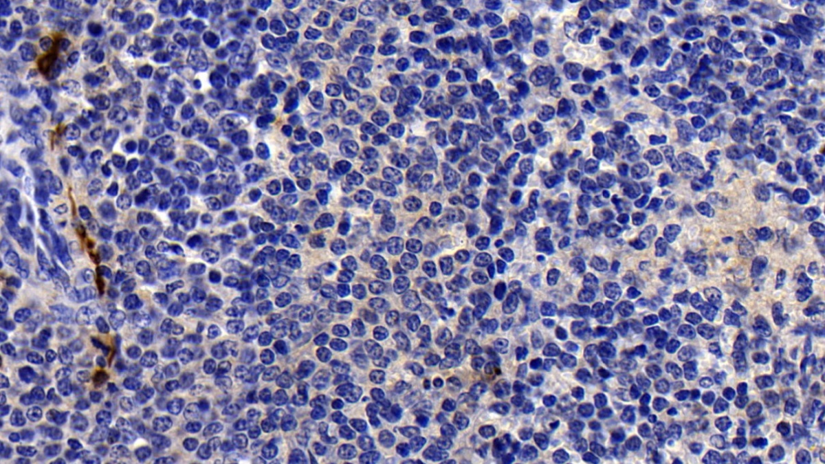 Tryptase (TPS) Pig Polyclonal Antibody