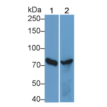 Interleukin 12 Receptor Beta 2 (IL12Rb2) Human Polyclonal Antibody