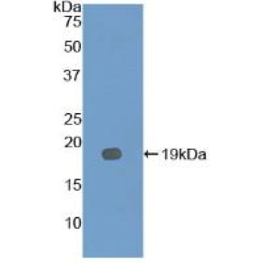 Interleukin 12 Receptor Beta 2 (IL12Rb2) Mouse Polyclonal Antibody
