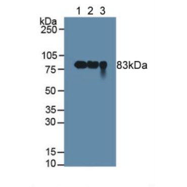 Polymeric Immunoglobulin Receptor (PigR) Human Polyclonal Antibody