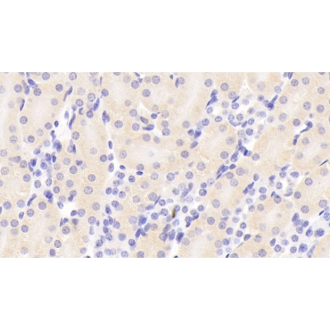 Polymeric Immunoglobulin Receptor (PigR) Mouse Polyclonal Antibody