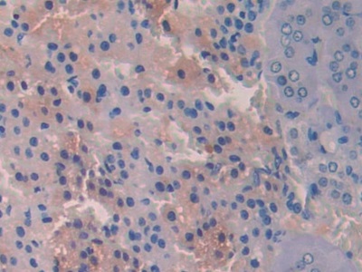 Polymeric Immunoglobulin Receptor (PigR) Rat Polyclonal Antibody
