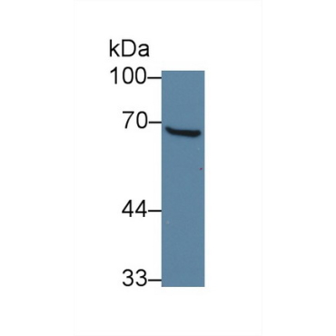 General Transcription Factor IIH Subunit 1 (GTF2H1) Human Polyclonal Antibody