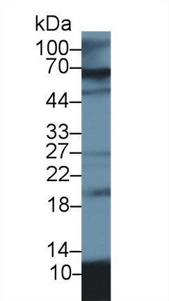 S100 Calcium Binding Protein A12 (S100A12) Pig Polyclonal Antibody