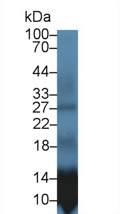 S100 Calcium Binding Protein A12 (S100A12) Rabbit Polyclonal Antibody
