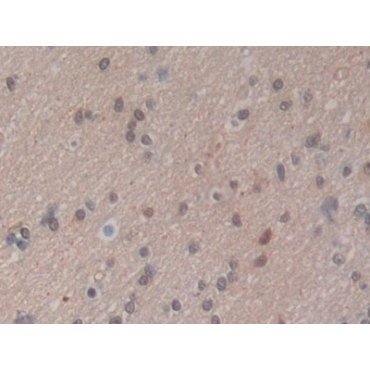 Heat Shock 70kDa Protein 1A (HSPA1A) Human Polyclonal Antibody
