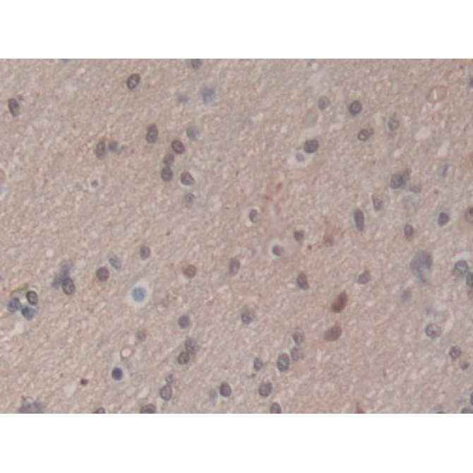 Heat Shock 70kDa Protein 1A (HSPA1A) Human Polyclonal Antibody