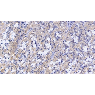 Heat Shock 70kDa Protein 9 (HSPA9) Human Polyclonal Antibody