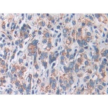 Superoxide Dismutase 2, Mitochondrial (SOD2) Human Polyclonal Antibody