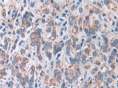 Superoxide Dismutase 2, Mitochondrial (SOD2) Human Polyclonal Antibody