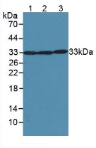 Superoxide Dismutase 2, Mitochondrial (SOD2) Mouse Polyclonal Antibody