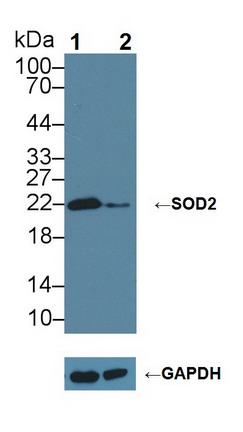 Superoxide Dismutase 2, Mitochondrial (SOD2) Rat Polyclonal Antibody
