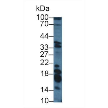 Galanin (GAL) Human Polyclonal Antibody