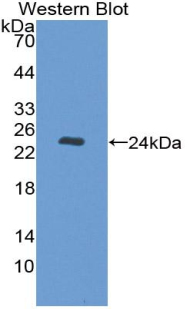 Nucleoporin 35kDa (NUP35) Human Polyclonal Antibody