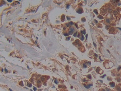 Nucleoporin 37 (NUP37) Human Polyclonal Antibody