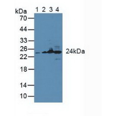 Glutathione S Transferase Kappa 1 (GSTk1) Mouse Polyclonal Antibody