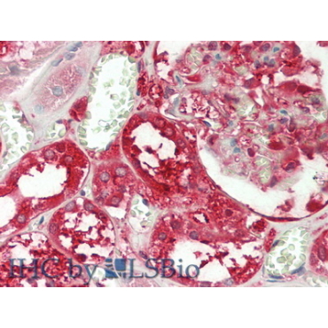 Glutathione S Transferase Pi (GSTp) Human Polyclonal Antibody