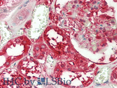 Glutathione S Transferase Pi (GSTp) Human Polyclonal Antibody