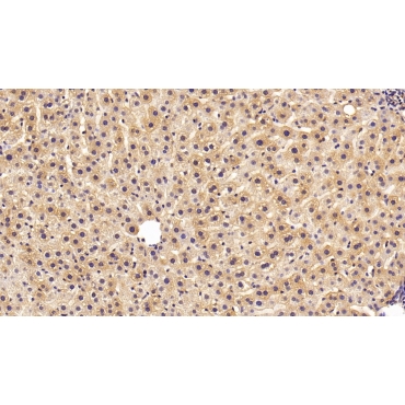 Glutathione S Transferase Pi (GSTp) Human Polyclonal Antibody