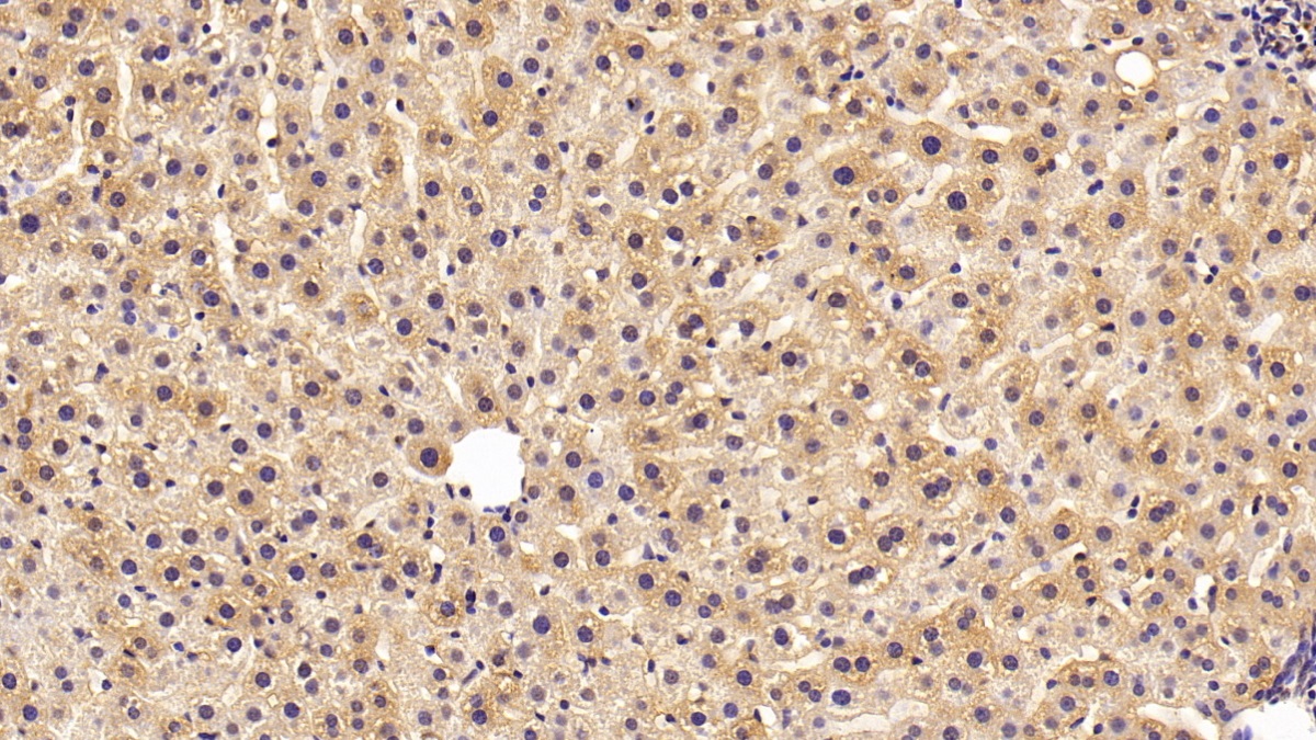 Glutathione S Transferase Pi (GSTp) Human Polyclonal Antibody