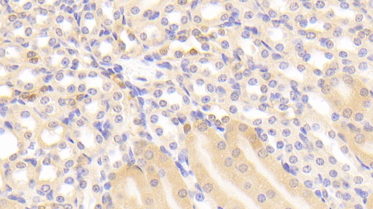 Glutathione S Transferase Pi (GSTp) Mouse Polyclonal Antibody