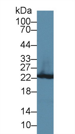 Glutathione S Transferase Pi (GSTp) Rat Polyclonal Antibody