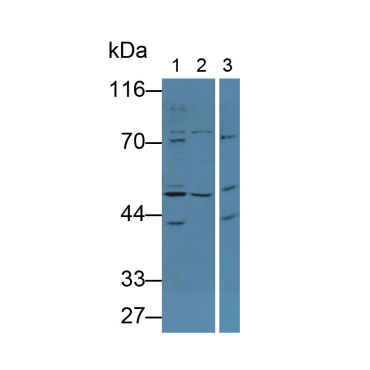 Alkaline Phosphatase, Tissue-nonspecific (ALPL) Human Polyclonal Antibody