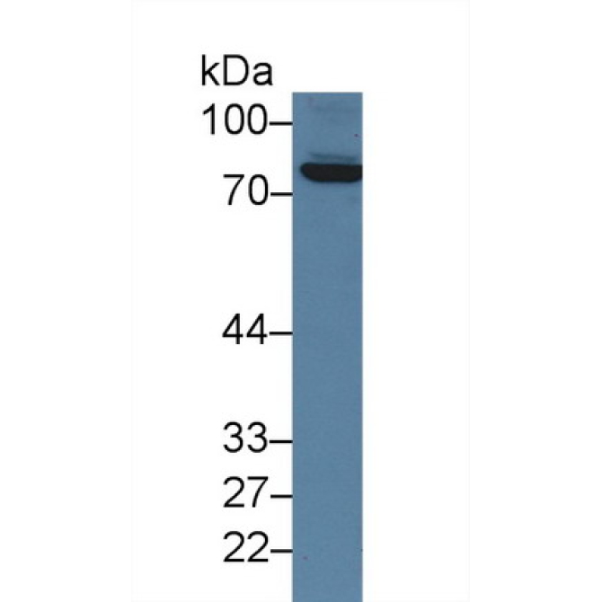 Coagulation Factor XIII A1 Polypeptide (F13A1) Mouse Polyclonal Antibody
