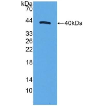 Motility Related Protein (MRP1) Human Polyclonal Antibody