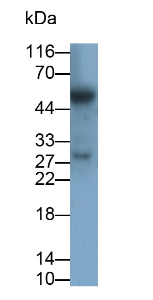 Cluster Of Differentiation 8a (CD8a) Human Polyclonal Antibody