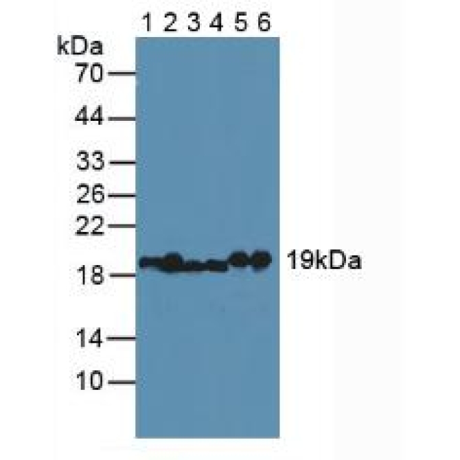 Myosin Light Chain 2 (MYL2) Human Polyclonal Antibody