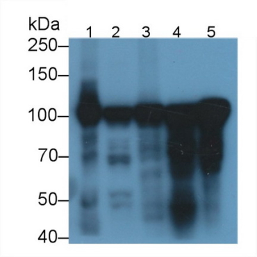 Actinin Alpha 3 (ACTN3) Human Polyclonal Antibody