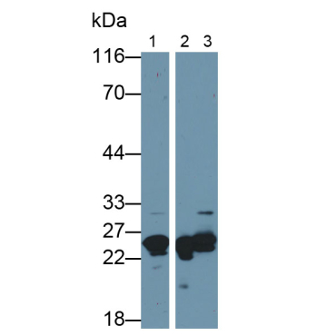Myosin Light Chain 1 (MYL1) Human Polyclonal Antibody