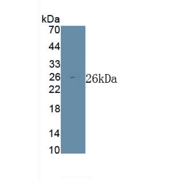 Low Density Lipoprotein (LDL) Human Polyclonal Antibody