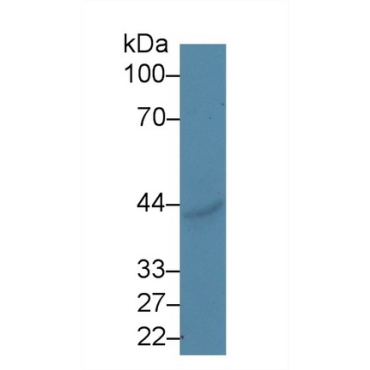 Ectonucleoside Triphosphate Diphosphohydrolase 1 (ENTPD1) Human Polyclonal Antibody