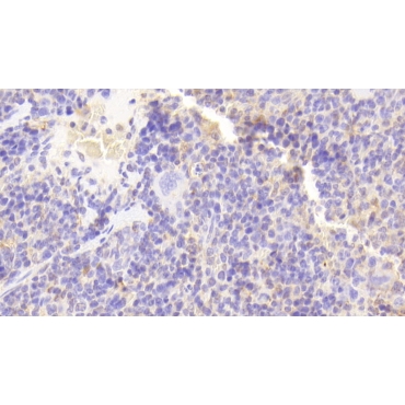Ectonucleoside Triphosphate Diphosphohydrolase 1 (ENTPD1) Mouse Polyclonal Antibody