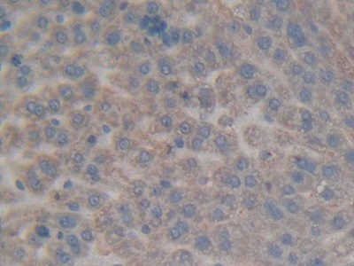 Ectonucleoside Triphosphate Diphosphohydrolase 1 (ENTPD1) Rat Polyclonal Antibody