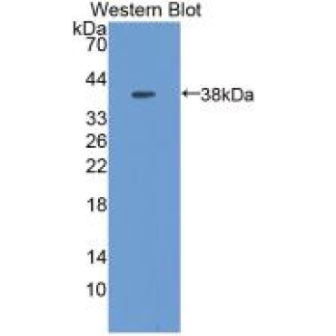 Metallothionein 1 (MT1) Mouse Polyclonal Antibody