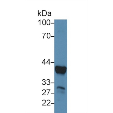 Arginase (ARG) Mouse Polyclonal Antibody