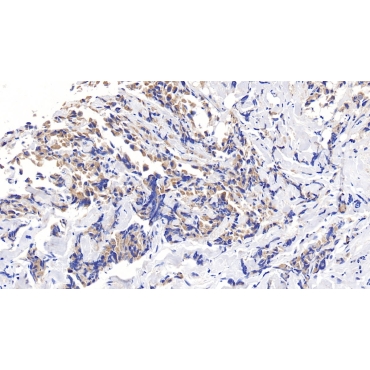 Chemokine C-C-Motif Ligand 14 (CCL14) Human Polyclonal Antibody