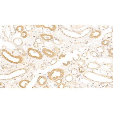 Complement Receptor 1, Erythrocyte (CR1) Human Polyclonal Antibody