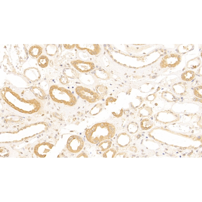 Complement Receptor 1, Erythrocyte (CR1) Human Polyclonal Antibody