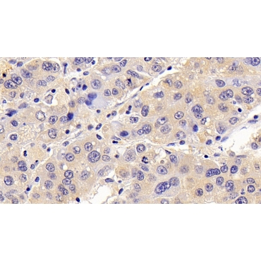 Chemokine C-C-Motif Ligand 16 (CCL16) Human Polyclonal Antibody