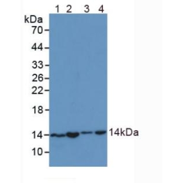 Small Nuclear Ribonucleoprotein Polypeptide D1 (SNRPD1) Human Polyclonal Antibody