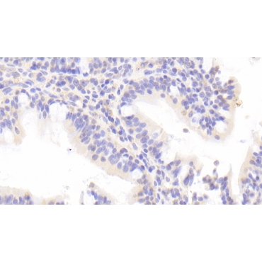 Chemokine C-C-Motif Ligand 1 (CCL1) Human Polyclonal Antibody