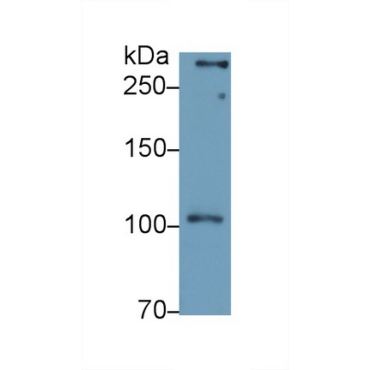 Chondroitin Sulfate Proteoglycan 4 (CSPG4) Human Polyclonal Antibody