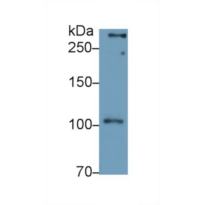 Chondroitin Sulfate Proteoglycan 4 (CSPG4) Human Polyclonal Antibody
